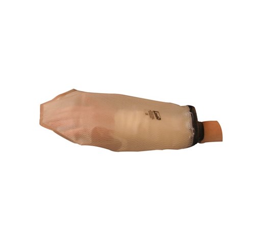 Limbo Adult hand injury